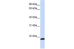 WB Suggested Anti-C21orf56 Antibody Titration:  0. (C21ORF56 抗体  (Middle Region))