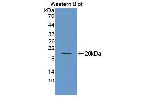 Western blot analysis of the recombinant protein. (Sonic Hedgehog 抗体  (AA 28-193))