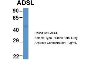 Host: Rabbit  Target Name: ADSL  Sample Tissue: Human Fetal Lung  Antibody Dilution: 1. (Adenylosuccinate Lyase 抗体  (Middle Region))