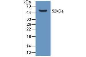 Detection of Recombinant APOD, Mouse using Polyclonal Antibody to Apolipoprotein D (APOD) (Apolipoprotein D 抗体  (AA 1-189))