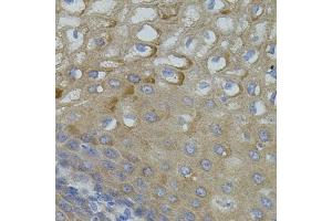 Immunohistochemistry (IHC) image for anti-Mitofusin 2 (MFN2) (AA 687-757) antibody (ABIN6143801)
