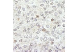 Immunohistochemistry (IHC) image for anti-Lysine (K)-Specific Demethylase 5B (KDM5B) (AA 1494-1544) antibody (ABIN7448613)