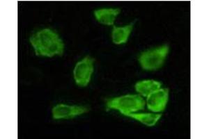 Immunofluorescence analysis of Hela cells using GSK3 alpha mouse mAb showing cytoplasmic localization. (GSK3 alpha 抗体)