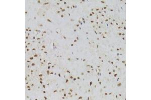Immunohistochemistry (Paraffin-embedded Sections) (IHC (p)) image for anti-Nuclear Autoantigenic Sperm Protein (Histone-Binding) (NASP) (AA 180-449) antibody (ABIN6144374)
