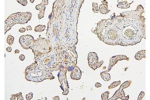 IHC analysis of IRS1 using anti-IRS1 antibody (ABIN7599659).