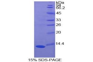 SDS-PAGE analysis of Cow S100A10 Protein. (S100A10 蛋白)
