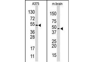 Western blot analysis of anti-HIF1AN (C-term) Pab in  and mouse brain cell line lysate.