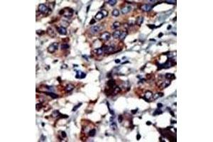Immunohistochemistry (Paraffin-embedded Sections) (IHC (p)) image for anti-Protein Kinase C and Casein Kinase Substrate in Neurons 3 (PACSIN3) (AA 1-30), (N-Term) antibody (ABIN392668)