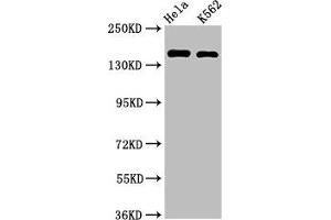 Western Blot Positive WB detected in: Hela whole cell lysate, K562 whole cell lysate All lanes: CDK12 antibody at 2 μg/mL Secondary Goat polyclonal to rabbit IgG at 1/50000 dilution Predicted band size: 165, 164, 142 kDa Observed band size: 165 kDa (CDK12 抗体  (AA 1309-1490))