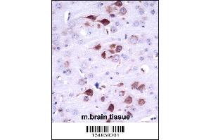 Mouse Matk Antibody immunohistochemistry analysis in formalin fixed and paraffin embedded mouse brain tissue followed by peroxidase conjugation of the secondary antibody and DAB staining. (MATK 抗体  (C-Term))
