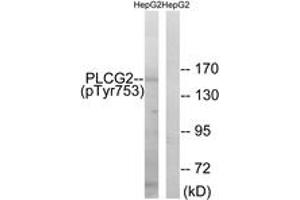 Western blot analysis of extracts from HepG2 cells treated with Na3VO4 0. (Phospholipase C gamma 2 抗体  (pTyr753))