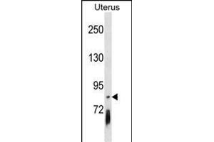 PCDHGB4 Antibody (Center) (ABIN1538347 and ABIN2850269) western blot analysis in Uterus tissue lysates (35 μg/lane). (PCDHGB4 抗体  (AA 353-379))