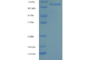 SDS-PAGE (SDS) image for Ribonucleotide Reductase M1 (RRM1) (AA 1-792), (full length) protein (His-SUMO Tag) (ABIN5710282) (RRM1 Protein (AA 1-792, full length) (His-SUMO Tag))