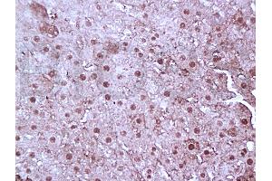 Formalin-fixed and paraffin embedded rat liver tissue labeled with Anti-FoxP3 Polyclonal Antibody, Unconjugated (ABIN727040) at 1:100, followed by conjugation to the secondary antibody and DAB staining (FOXP3 抗体)