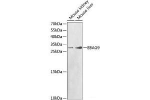 Western blot analysis of extracts of various cell lines using EBAG9 Polyclonal Antibody at dilution of 1:1000. (RCAS1 抗体)