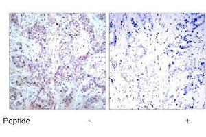Image no. 1 for anti-Nuclear Factor-kB p65 (NFkBP65) (AA 534-538) antibody (ABIN197117) (NF-kB p65 抗体  (AA 534-538))