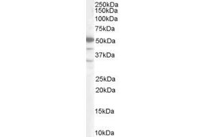 Western Blotting (WB) image for anti-SWI/SNF Related, Matrix Associated, Actin Dependent Regulator of Chromatin, Subfamily E, Member 1 (SMARCE1) (C-Term) antibody (ABIN2465457) (SMARCE1 抗体  (C-Term))