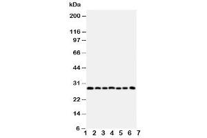 Western blot testing of Kallikrein-11 antibody and Lane 1:  U87 (Kallikrein 11 抗体  (C-Term))