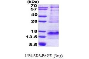 SDS-PAGE (SDS) image for Brain Expressed, X-Linked 1 (BEX1) (AA 1-125) protein (His tag) (ABIN6387227) (BEX1 Protein (AA 1-125) (His tag))