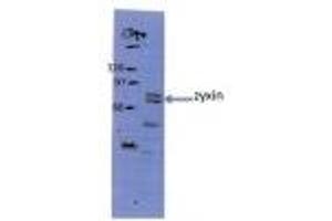 Sample Type: HeLa whole cell lysatePrimary Dilution: 1:200 ZYX is strongly supported by BioGPS gene expression data to be expressed in Human HeLa cells (ZYX 抗体  (Middle Region))