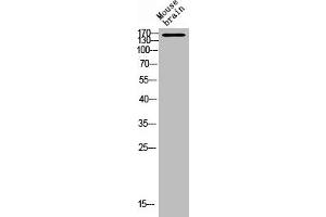Western Blot analysis of MOUSE-BRAIN cells using DAPK1 Polyclonal Antibody (DAP Kinase 1 抗体)
