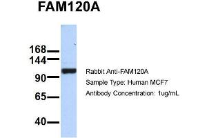 Host: Rabbit   Target Name: FAM120A   Sample Tissue: MCF7  Antibody Dilution: 1. (FAM120A 抗体  (Middle Region))
