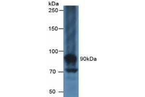 Detection of CA125 in Human Liver Tissue using Polyclonal Antibody to Carbohydrate Antigen 125 (CA125) (MUC16 抗体  (AA 13977-14117))