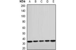 Western blot analysis of ETFA expression in A549 (A), HepG2 (B), mouse kidney (C), mouse heart (D), rat liver (E) whole cell lysates. (ETFA 抗体)