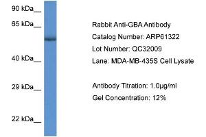 Western Blotting (WB) image for anti-Glucosidase, Beta, Acid (GBA) (C-Term) antibody (ABIN2788767)