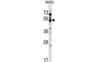 Western Blotting (WB) image for anti-G Protein-Coupled Receptor 84 (GPR84) antibody (ABIN2999428) (GPR84 抗体)