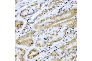 Immunohistochemical analysis of SUFU staining in human stomach formalin fixed paraffin embedded tissue section. (SUFUH 抗体)