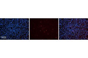 Rabbit Anti-Ppara Antibody  Catalog Number: ARP34068_P050 Formalin Fixed Paraffin Embedded Tissue: Human Adult liver  Observed Staining: Nuclear and some weak cytoplasmic Primary Antibody Concentration: 1:600 Secondary Antibody: Donkey anti-Rabbit-Cy2/3 Secondary Antibody Concentration: 1:200 Magnification: 20X Exposure Time: 0. (PPARA 抗体  (C-Term))