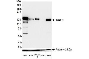 Western Blotting (WB) image for anti-Epidermal Growth Factor Receptor (EGFR) (C-Term) antibody (ABIN7795642)