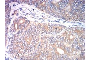 Immunohistochemistry (IHC) image for anti-Calreticulin (CALR) (AA 18-417) antibody (ABIN7193510)