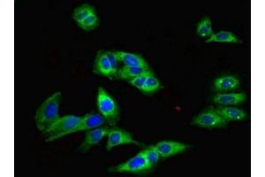 Immunofluorescence (IF) image for anti-Transient Receptor Potential Cation Channel, Subfamily M, Member 2 (TRPM2) (AA 60-119) antibody (ABIN7172859)
