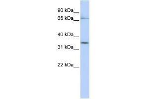 WB Suggested Anti-SLCO1C1 Antibody Titration:  0. (SLCO1C1 抗体  (N-Term))