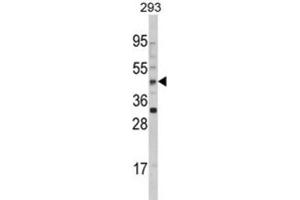 Western Blotting (WB) image for anti-Arylacetamide Deacetylase (Esterase) (AADAC) antibody (ABIN3002812) (AADAC 抗体)