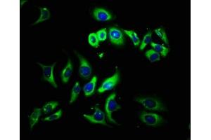 Immunofluorescence staining of A549 cells with ABIN7142652 at 1:133, counter-stained with DAPI.