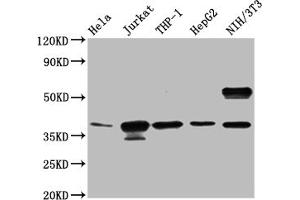 Western blot All lanes: CLYBL antibody at 1 μg/mL Lane 1: Hela whole cell lysate Lane 2: NIH/3T3 whole cell lysate Secondary Goat polyclonal to rabbit IgG at 1/10000 dilution Predicted band size: 38, 34 kDa Observed band size: 38 kDa (CLYBL 抗体  (AA 23-340))