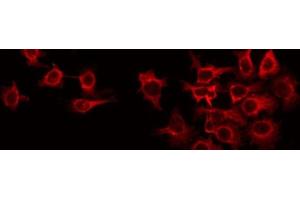 ABIN6266631 staining Hela by IF/ICC. (RIT1 抗体  (C-Term))