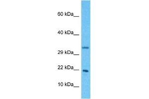 Western Blotting (WB) image for anti-NADH Dehydrogenase (Ubiquinone) 1 beta Subcomplex, 11, 17.3kDa (NDUFB11) (N-Term) antibody (ABIN5517203)