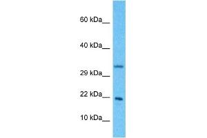 Host:  Rabbit  Target Name:  NDUFB11  Sample Type:  Hela Whole Cell lysates  Antibody Dilution:  1.