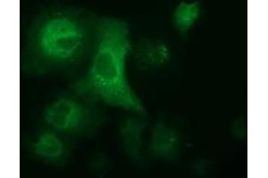 Anti-ALDH1L1 mouse monoclonal antibody (ABIN2452748) immunofluorescent staining of COS7 cells transiently transfected by pCMV6-ENTRY ALDH1L1 (RC213720). (ALDH1L1 抗体)