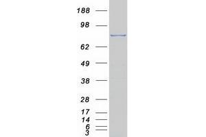 Validation with Western Blot