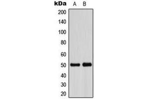 Western blot analysis of ADPGK expression in HeLa (A), VEC (B) whole cell lysates.