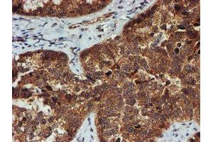 Image no. 10 for anti-Proteasome Subunit alpha 6 (PSMA6) antibody (ABIN1500463)