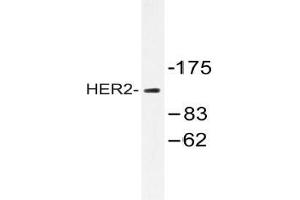 Western blot analysis of HER2 antibody in extracts from 293 cells. (ErbB2/Her2 抗体)