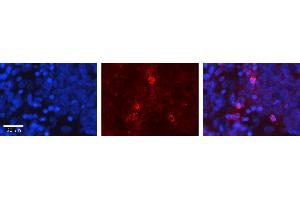Rabbit Anti-GNA12 Antibody Catalog Number: ARP54813_P050 Formalin Fixed Paraffin Embedded Tissue: Human Ovary Tissue Observed Staining: Plasma membrane Primary Antibody Concentration: 1:100 Other Working Concentrations: 1:600 Secondary Antibody: Donkey anti-Rabbit-Cy3 Secondary Antibody Concentration: 1:200 Magnification: 20X Exposure Time: 0. (GNA12 抗体  (Middle Region))