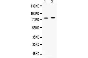 Western Blotting (WB) image for anti-Acyl-CoA Synthetase Long-Chain Family Member 5 (ACSL5) (AA 337-378), (Middle Region) antibody (ABIN5518721)