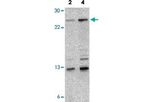 Western blot analysis of NKIRAS1 in 293 cell lysate with NKIRAS1 polyclonal antibody  at 2 and 4 ug/mL . (NKIRAS1 抗体  (Internal Region))